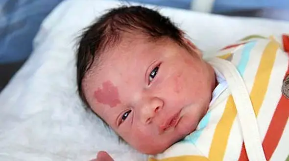  نوزادی که با علامت عشق به دنیا آمد+تصاویر