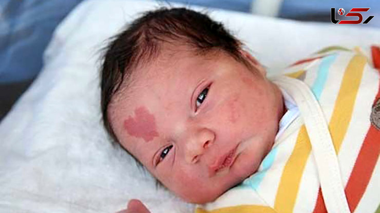  نوزادی که با علامت عشق به دنیا آمد+تصاویر