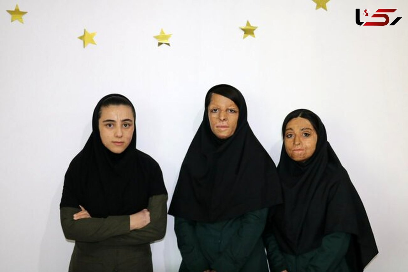 آخرین خبر از دختران سوخته شین آبادی در مدرسه + عکس 