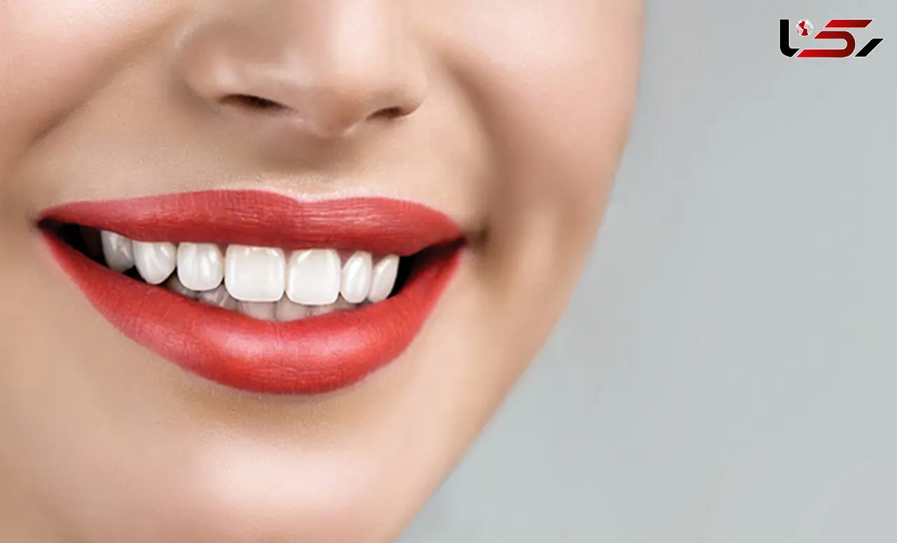 کلینیک دندانپزشکی زیبایی در اصفهان