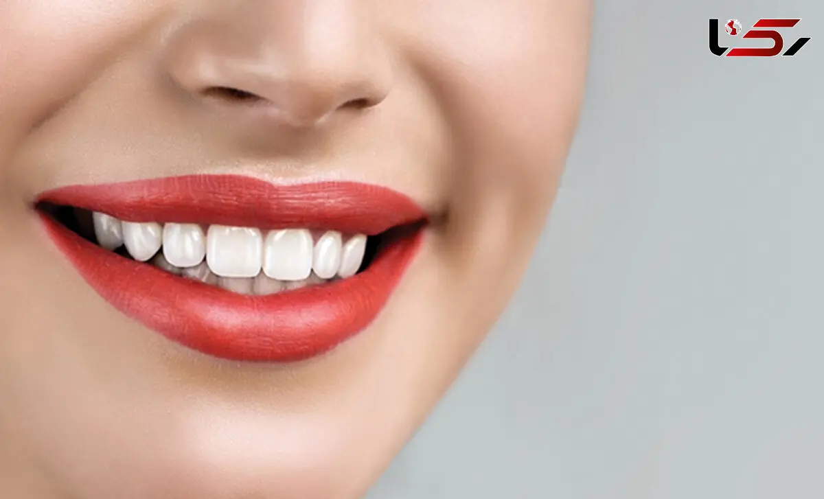 کلینیک دندانپزشکی زیبایی در اصفهان