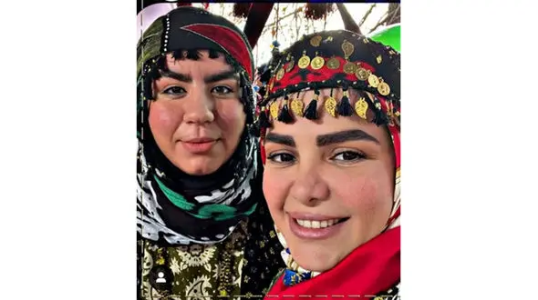 عکس عمل های عروسکی 2 خانم بازیگر نون خ / خارج صدا و سیما کولاک کردند!