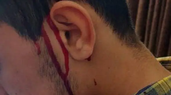 ضرب و شتم یک دانشجو توسط راننده سرویس  دانشگاه جندی شاپور اهواز! / ادعایی که باید مورد بررسی قضایی قرار گیرد

