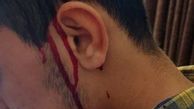 ضرب و شتم یک دانشجو توسط راننده سرویس  دانشگاه جندی شاپور اهواز! / ادعایی که باید مورد بررسی قضایی قرار گیرد

