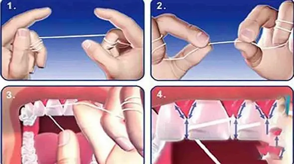 4 نکته کلیدی استفاده درست از نخ دندان