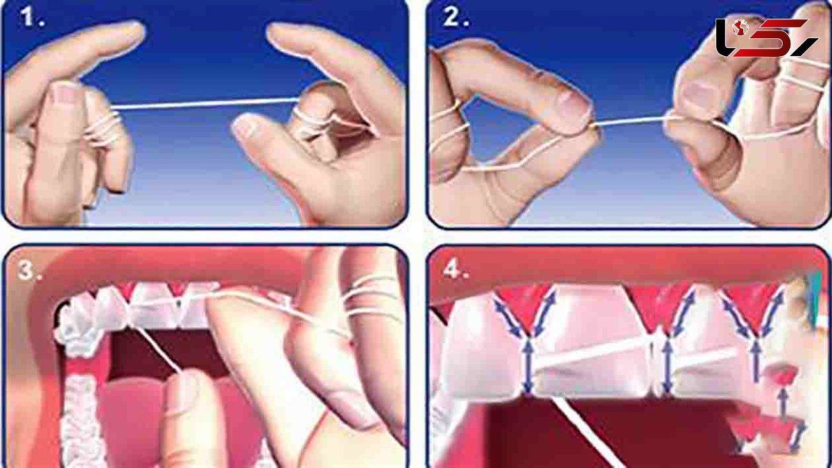 4 نکته کلیدی استفاده درست از نخ دندان