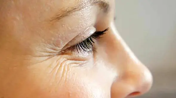 نحوه محو خطوط عمیق چهره