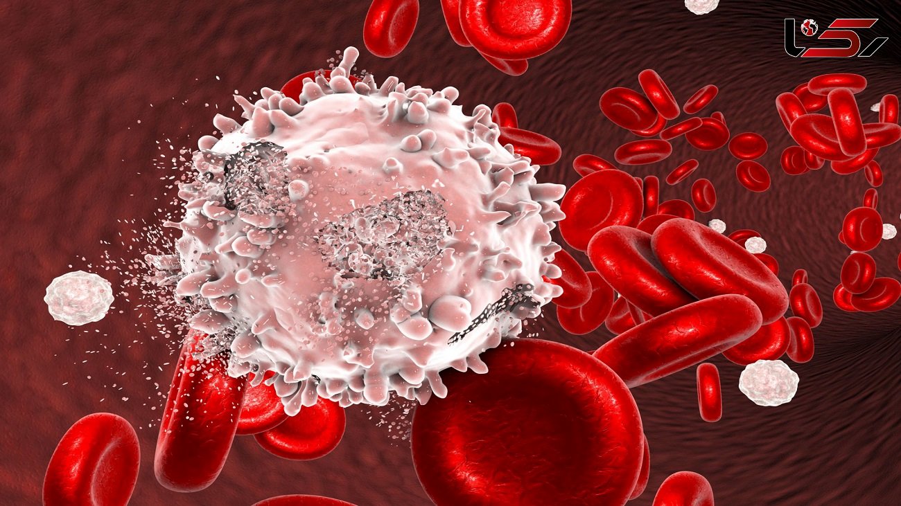 مهمترین نشانه های سرطان خون چیست؟