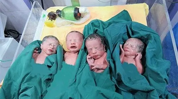 چهارقلوها در کالپوش رانش دیده به دنیا آمدند