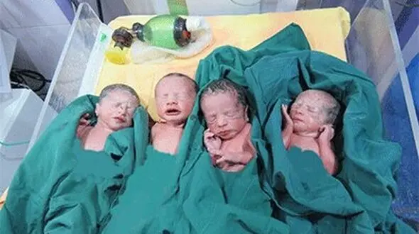 چهارقلوها در کالپوش رانش دیده به دنیا آمدند