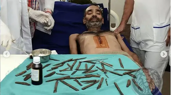 این مرد چاقو می خورد / خارج کردن 40 چاقو از شکم مرد هندی+ عکس های باورنکردنی