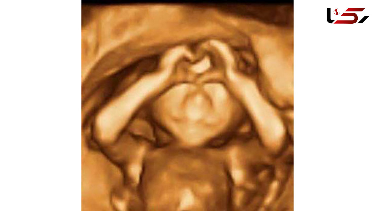  ژست جالب جنین درون شکم مادرش +عکس 