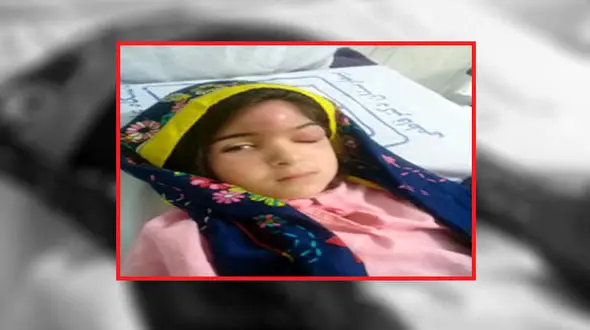 آخرین خبر از معلم اردبیلی که جمجمه آیناز را شکست !+عکس