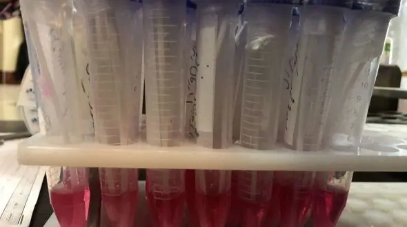 تکذیب مرگ زن مشکوک به کرونا در تهران