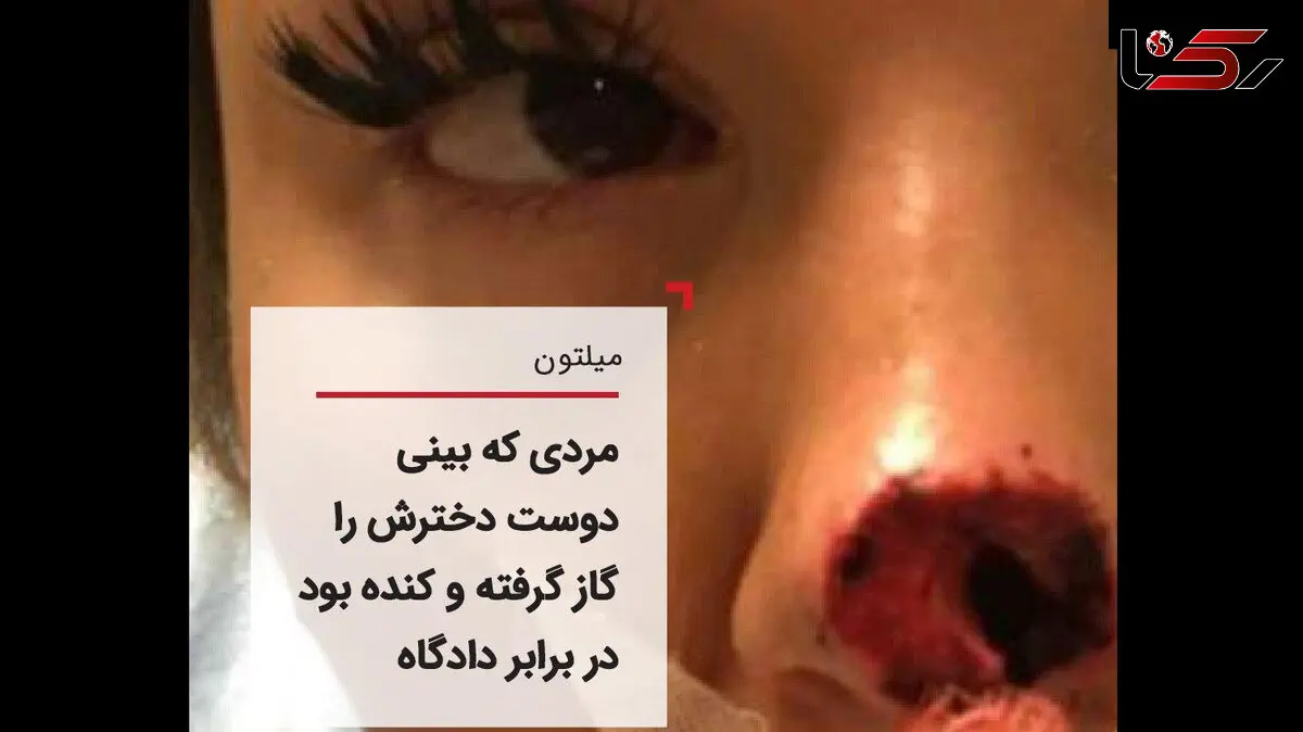 تشریح دادگاه مردی که بینی دوست دخترش را خورده بود+ عکس 