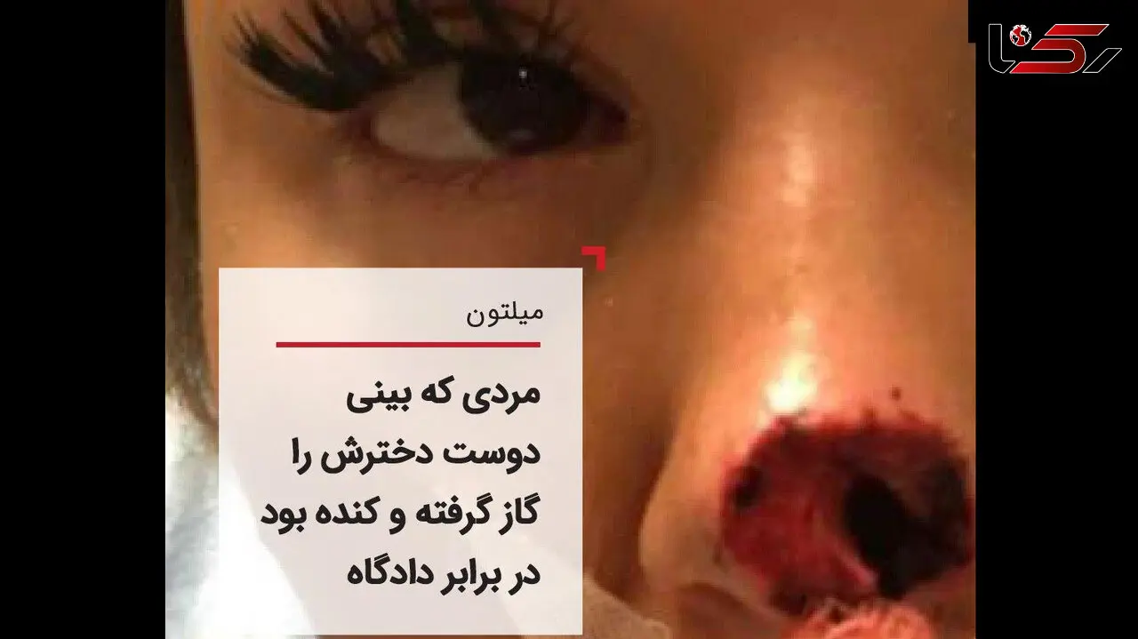 تشریح دادگاه مردی که بینی دوست دخترش را خورده بود+ عکس 