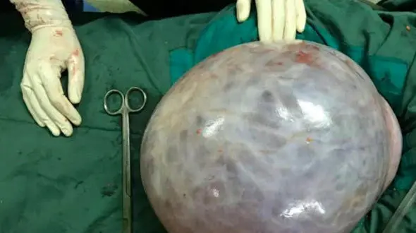 زن 52 ساله اردبیلی در 2 دقیقه 11 کیلو لاغر شد + عکس