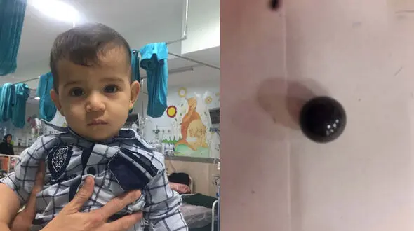 هشدار به مادران / تیله بازی این پسر 9 ماهه را تا پای مرگ برد !+عکس
