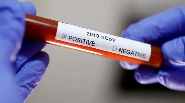 مردان بیشتر از زنان کرونا می گیرند !