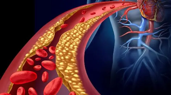 5 تکنیک تایید شده پزشکی برای کاهش کلسترول