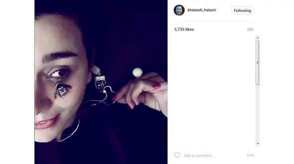 سلفی بازیگر معروف با زنبوری + عکس