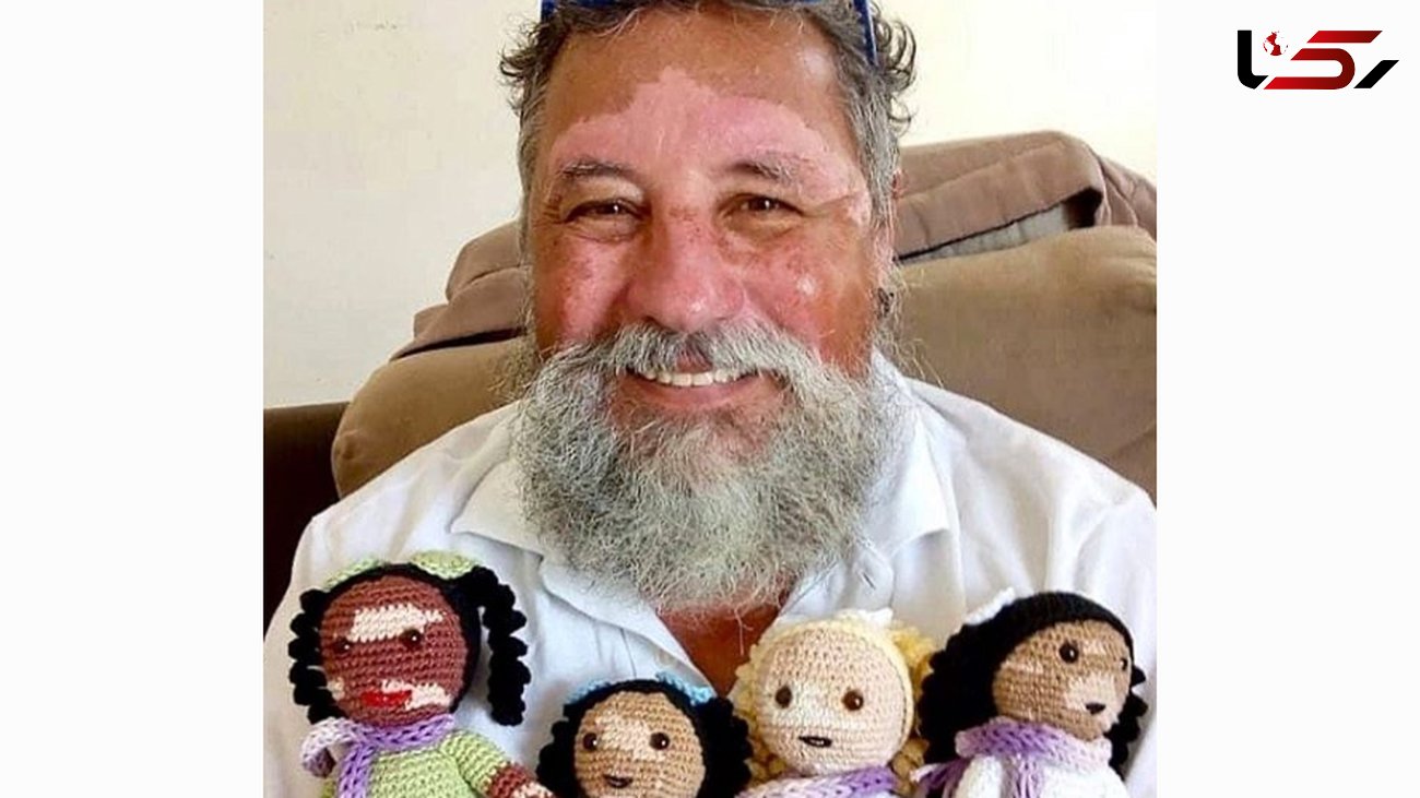 عروسک هایی که به صاحب مریضشان شباهت دارند!+عکس