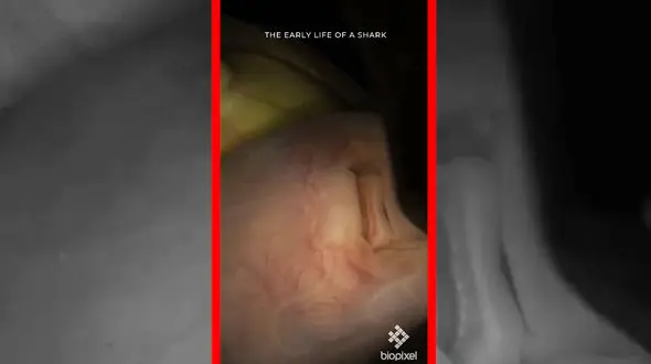 فیلم صحنه‌های نادر از جنین کوسه پلنگی