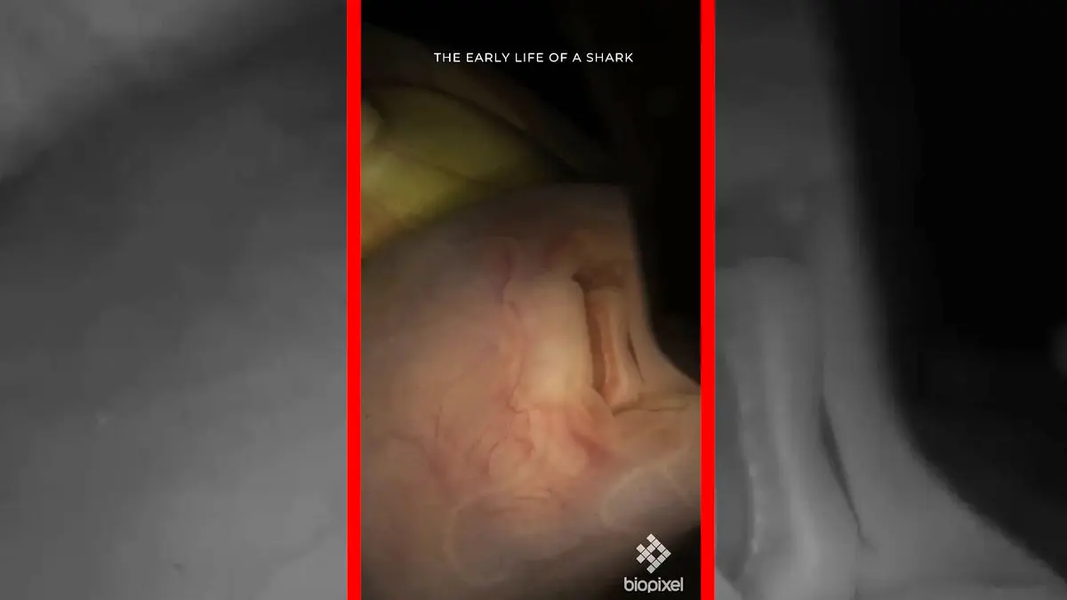 فیلم صحنه‌های نادر از جنین کوسه پلنگی