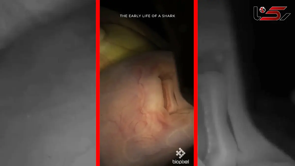 فیلم صحنه‌های نادر از جنین کوسه پلنگی