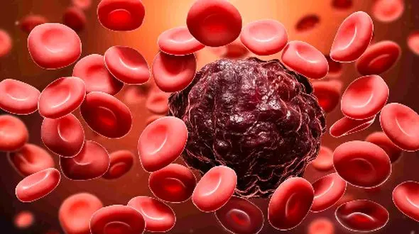 نشانه‌ های شایع و ناشناخته سرطان خون