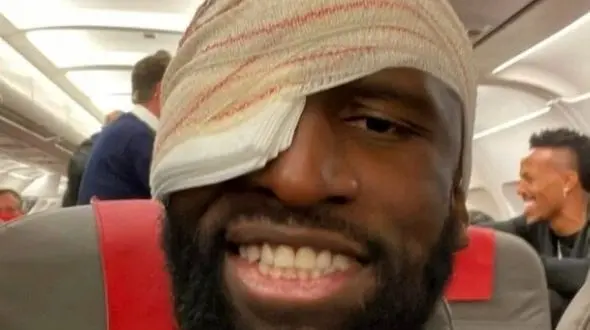 چشم پر از خون و 20 بخیه حاصل شجاعت ستاره رئال مادرید +عکس