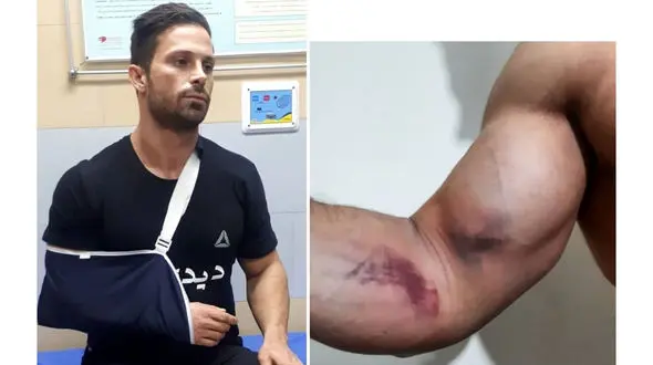 حمله مرموز به بدنساز تهرانی در مسیر فرودگاه رشت / جمعه شب گذشته رخ داد