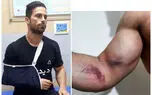 حمله مرموز به بدنساز تهرانی در مسیر فرودگاه رشت / جمعه شب گذشته رخ داد
