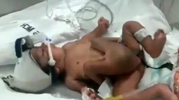 تولد نوزاد چهار پا در هندوستان + تصاویر 