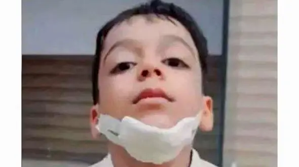 سیلی‌های مرگبار / معلم کهنوجی فک دانش‌آموز را خرد کرد + عکس و فیلم