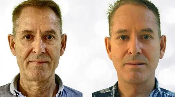 پیشگیری از افتادگی پوست با چند گام ساده/بدون هزینه زیباتر شوید