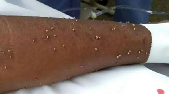 مرگ دردناک یک زن با نیش زنبور/عکس باورنکردنی را ببینید + تصاویر 