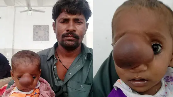 به دنیا آمدن یک کودک وحشتناک پاکستانی+ عکس