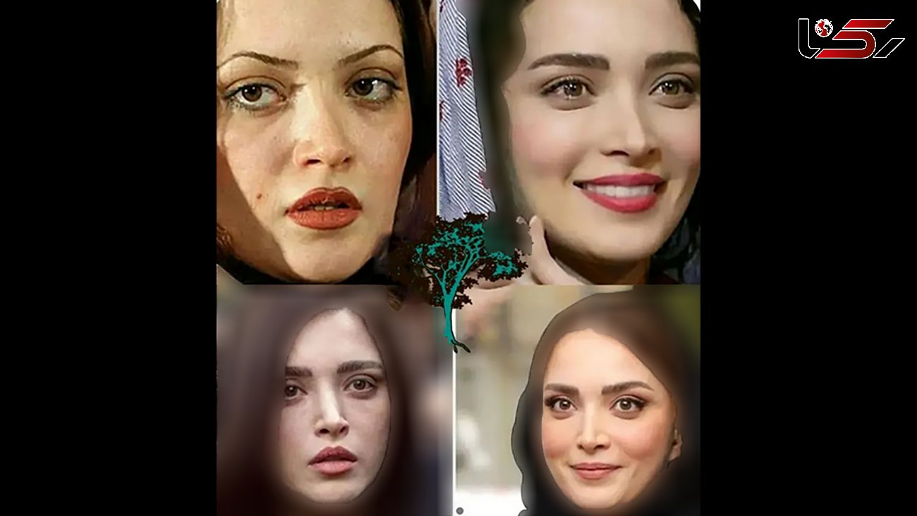 خانم بازیگرانی که چهر طبیعی خود را عروسکی کردند / جراحی های فانتزی و زننده + عکس و اسامی