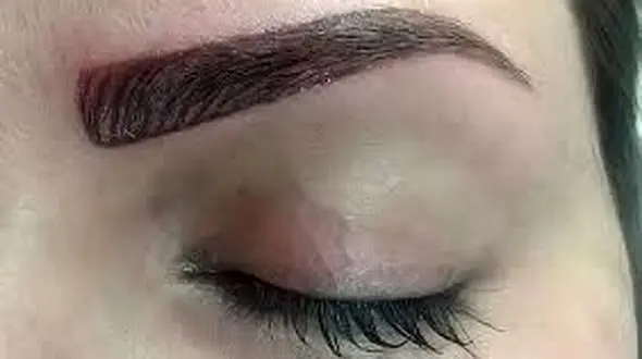 پاک کردن تاتو غیرممکن است