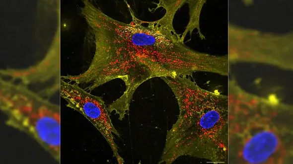 Scientists Explore New Method to Boost Energy in Aging Cells