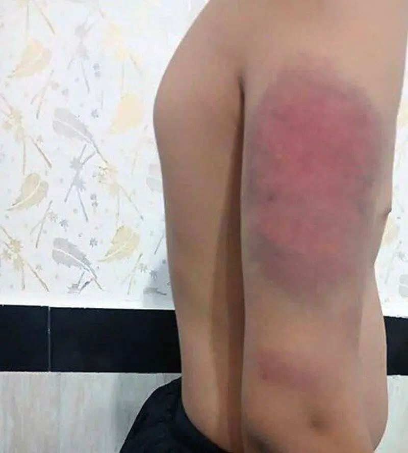 ضرب و شتم دانش آموز