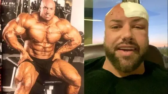  تومور مغزی قهرمان پرورش اندام جهان! + عکس و فیلم