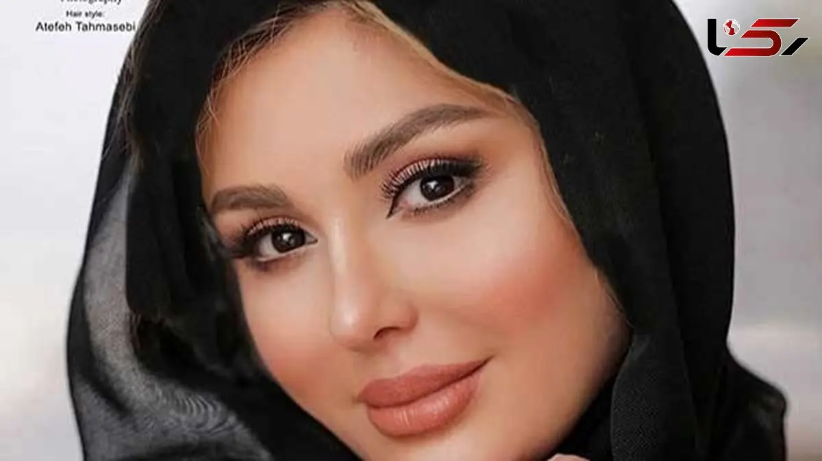 فیلم / نیوشا ضیغمی: وضعیت خیلی بدی داشتم و مجبور شدم  عمل کنم / عمل خیلی سنگینی بود/ چیکار به دماغ من دارید