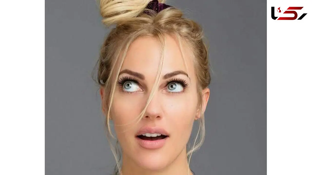 تغییر چهره بازیگر زن معروف بعد عمل زیبایی/ خرم سلطان دیگر قابل شناسایی نیست!