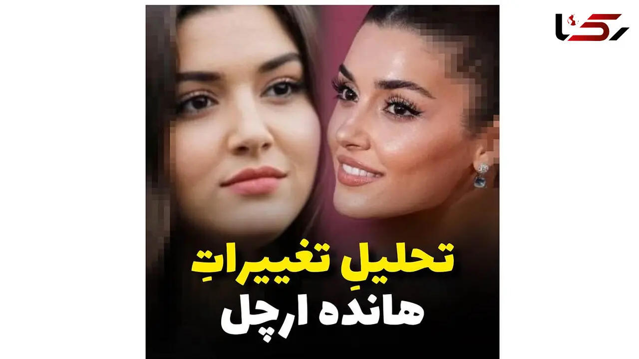 هانده ارچل چگونه زیباترین بازیگر خاورمیانه شد؟ / فیلم همه عمل های زیبایی خانم بازیگر ترک