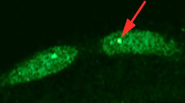 کشف راز و رمز پیری سالم