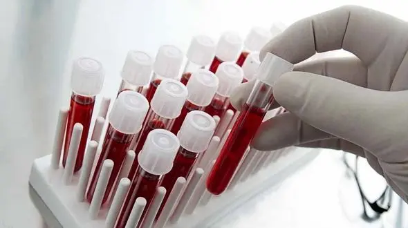 پیش بینی مرگ با یک تست خون ساده