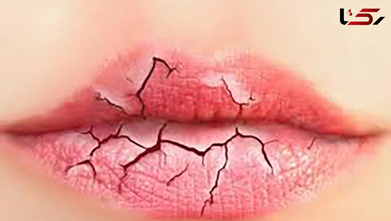 عجیب ترین طالع بینی از شکل لب هایتان / از لب پر تا لب غنچه ای و از لب نازک تا لب های قلبی + عکس و شرح