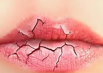 عجیب ترین طالع بینی از شکل لب هایتان / از لب پر تا لب غنچه ای و از لب نازک تا لب های قلبی + عکس و شرح
